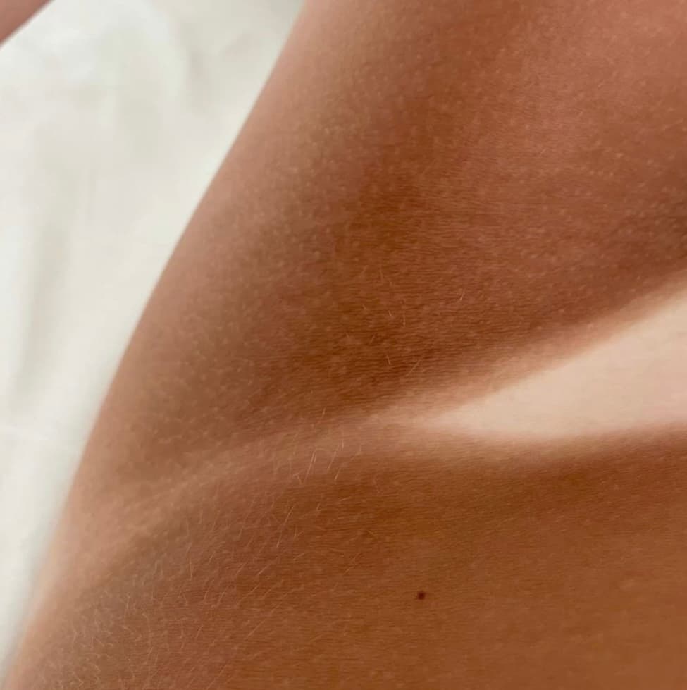 Résultat bronzage Glow 17 27